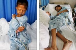 Lima Tahun Menahan Kelaparan Demi Pengobatan Adik, Wanita ini Akhirnya Meninggal