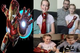 Keren, Gadis Cilik Ini Punya Lengan Bionik 'Iron Man'