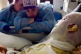 Tubuhnya Terbakar dari Dalam, Kulit Pria Ini Terpaksa Dibalut Kulit Babi