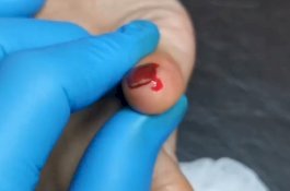 Dua Perempuan Digigit Tikus saat Nonton Bioskop, Satu Kelingkingnya Berdarah