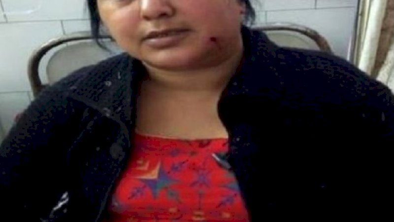 Perempuan Tangguh, Berkendara 7 Kilometer dengan 3 Luka Tembak di Kepala