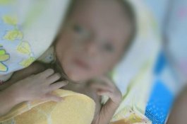Pasien Gizi Buruk di Jeneponto Meninggal, Dokter: