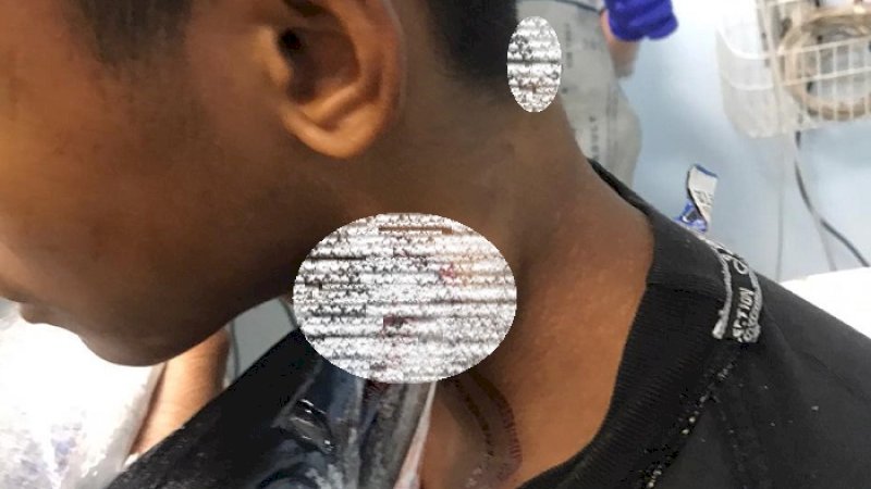 Idul dan ikan sori yang menusuk lehernya.