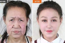 Sering Dibully Karena Mirip Nenek-nenek, Gadis 15 Tahun ini Akhirnya Diberi 'Wajah Baru'