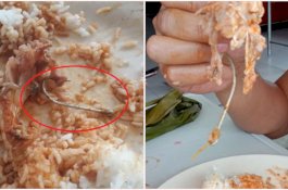 Asyik Makan, Wanita Ini Hampir Menelan Kail Pancingan yang Masih Tertancap di Ikan