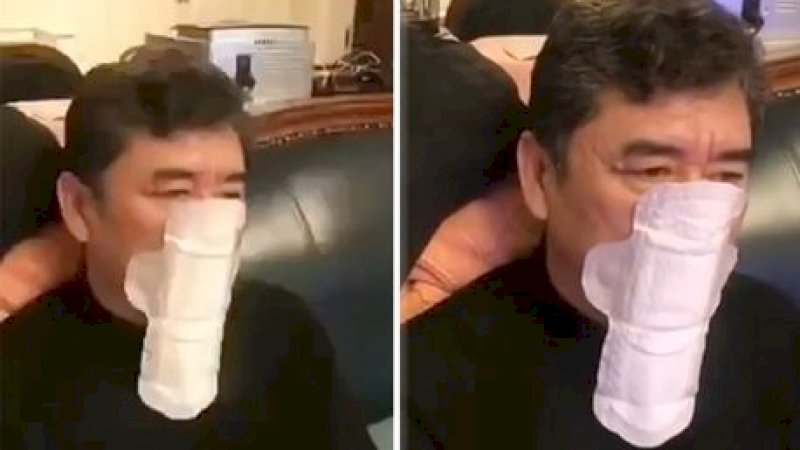 Hindari Coronavirus di China, Pria Ini Pakai Pembalut Tutupi Hidung dan Mulut