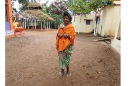 Hanya Satu di Dunia, Wanita Ini Punya 19 Jari Kaki dan 12 Jari Tangan