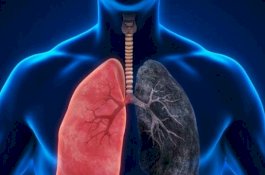 Paru-Paru Bisa secara 'Ajaib' Perbaiki Mutasi Kanker Akibat Rokok, Syaratnya Sederhana
