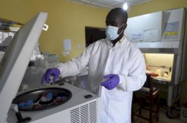 Demam Lassa Tewaskan 19 Orang, Virus Pembunuh di Nigeria Bisa Buat Korbannya Berdarah di Mulut