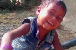 Bocah 3 Tahun 'Direbus' Hidup-hidup Setelah Jatuh di Panci Raksasa