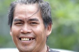 Pengakuan Mengejutkan Komedian Bopak, Hidup dengan 1 Paru-Paru