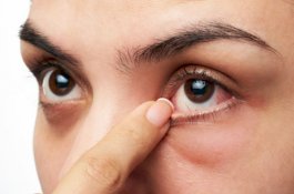 6 Kondisi Mata Bisa Deteksi Jenis Penyakit, Cek Matamu Sekarang