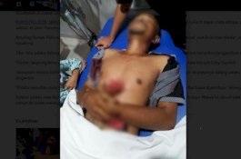Sadis! Ali Dibunuh di Depan Istrinya Pakai Busur dan Parang