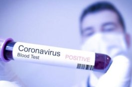 Heboh Peneliti Harvard Prediksi Virus Corona Masuk Indonesia