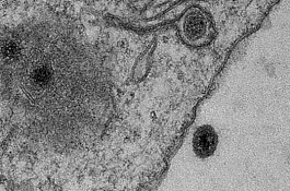 Virus Misterius di Brazil, Ilmuan Bingung karena 90% Baru