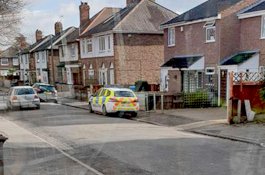 Bayi Perempuan Alami Luka Serius Usai Digigit Anjing, Polisi Diterjunkan