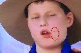 Muncul di TV, Bocah ini Terekam Makan 2 Lalat yang Mendarat di Wajahnya