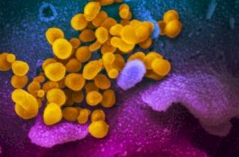 Begini Penampakan Virus Corona yang Mematikan