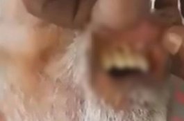 Puluhan Belatung Ditemukan Anak di Mulut Ayahnya yang Lumpuh Tak Terawat