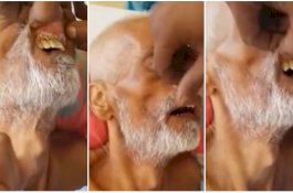 Manusia dengan Belatung di Mulutnya Meninggal, Keluarga Curigai Rumah Sakit