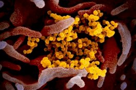 Waspada, IDI Sebut Virus Corona Bisa Menular Lewat Air Liur, Batuk dan Bersin