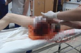 Usai Minum Pil Zombie, Pria ini Tak Sadar Gergaji Kakinya Hingga Putus