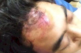 Siswa Ditarik Preman Keluar dari Kelas saat Belajar, Dipukul Hingga Benjol di Kepala