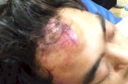 Siswa SMKN Gowa Dikeroyok Preman dalam Kelas, Pelaku Bawa ke RS Setelah Sadar Salah Orang