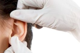 Wanita Ini Kehilangan Satu Telinganya Gara-Gara Sunbeds yang Berujung Kanker