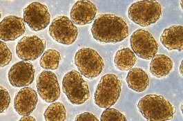 Eksperimen Baru Sel Punca Manusia Diklaim Bakal Bisa Sembuhkan Diabetes