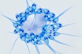 Makhluk ini Satu-satunya Hewan yang Dapat Bertahan Hidup Tanpa Oksigen