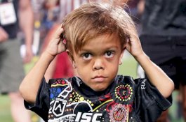 Bocah Australia yang Viral Karena Dibully Akan Sumbangkan Rp6,7 Miliar untuk Amal