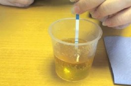 Tidak Sekalipun Mengonsumsinya, Perempuan Ini Kencing Alkohol