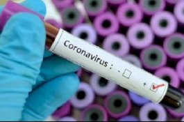 Ahli Kesehatan Curiga Virus Corona Sudah Ada di Indonesia