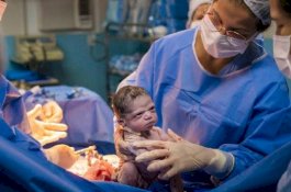 Coba Dibuat Menangis, Bayi yang Baru Lahir Pasang Wajah Sangar ke Dokter