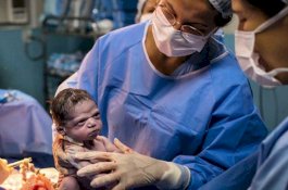 Sambil Tertawa, Begini Tanggapan Orang Tua Bayi yang Cemberut saat Dilahirkan