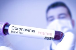 Wanita Ini Positif Virus Corona Usai 8 Kali Tes yang Hasilnya Negatif