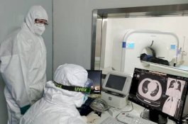 Dokter China Sukses Melakukan Transplantasi Paru-paru Pada Pasien Covid-19