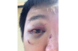 Gegara Tak Bisa Bahasa Inggris, Pelajar Tiongkok Babak Beluar di Australia