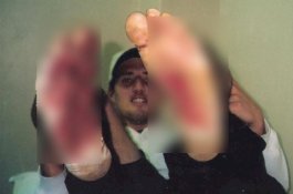 Pria Ini Masih Tetap Hidup Meski Sudah Ditusuk dan Ditembak Berkali-kali