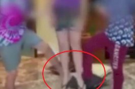 Bocah 13 Tahun Geger Otak Gegara Bikin Video 'Challenge' untuk TikTok