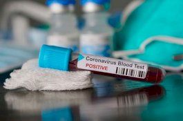 80.651 Orang Positif Virus Corona di China, 55.404 Pasien Sembuh