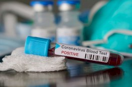 Dua Pasien Virus Corona di Indonesia Sembuh