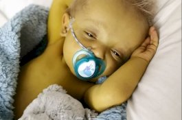 Kulit Bayi ini Berwarna Kuning Akibat Penyakit Langka, Malah Disamakan Minion