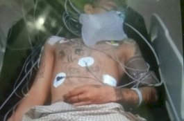 Polisi Ungkap Fakta Pemuda yang Kena Tembak di Bantaeng