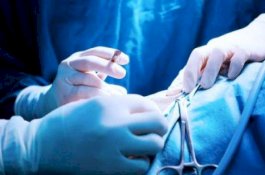 Alergi Obat, Wanita Ini Harus Kehilangan Kedua Tangan dan Kakinya