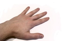 Suami Bawa Potongan Tangan Manusia ke Rumah, 