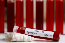 Penelitian Terbaru, Virus Corona Bisa Bertahan Berjam-jam di Permukaan Benda