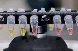 Dibocorkan Fadli Zon, Alat Rapid Test yang Didatangkan dari China Harganya Rp55 Ribu Per Satuan