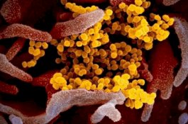 Satu Pasien Asal Sidrap Positif Covid-19